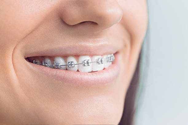 Best Traditional Braces  in Rushville, IN